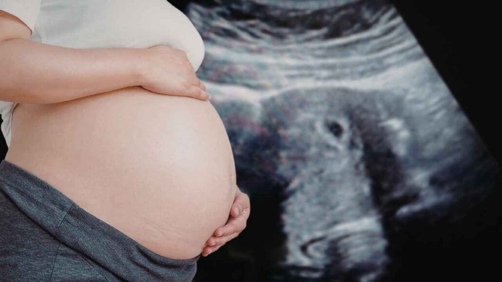 Close de barriga de gestante com imagem de ultrassom ao fundo